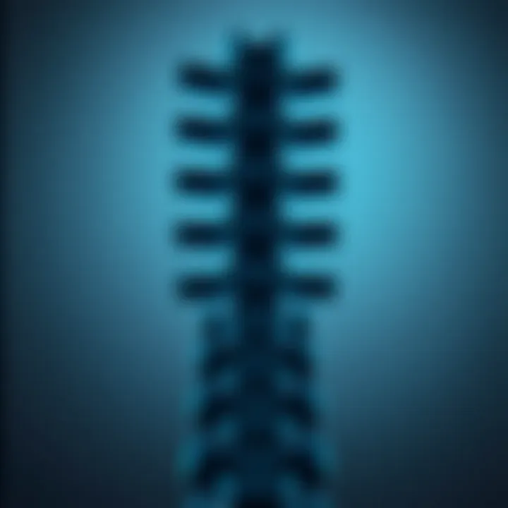 Magnificent Understanding Spondylosis of the Spine: A Comprehensive Overview