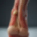 Anatomy of the Achilles tendon