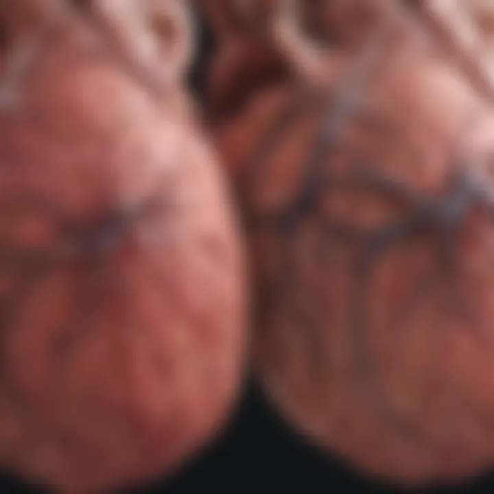 Chart comparing symptoms of atrial fibrillation and atrial fibrillation with rapid ventricular response