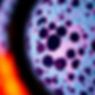 Microscopic Examination of MCL Cells Microscopic view of mantle cell lymphoma cells