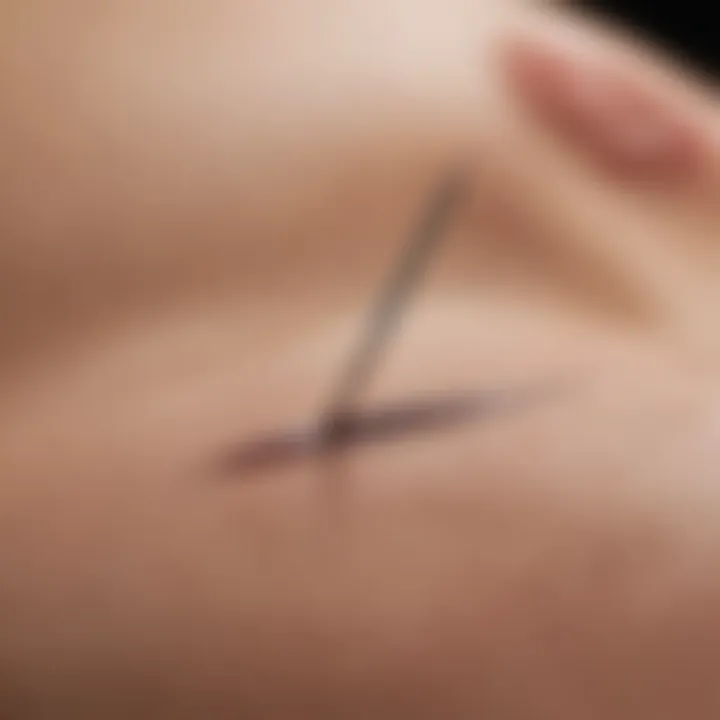 An arrowhead needle positioned on a targeted acupuncture point