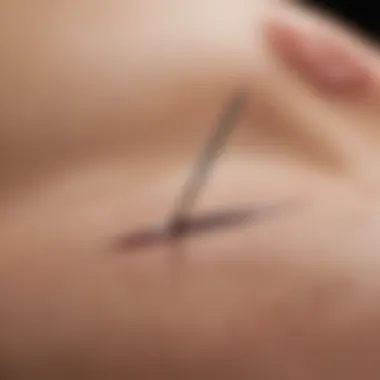 The Arrowhead Technique in Focus An arrowhead needle positioned on a targeted acupuncture point