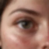 Eczema skin condition with visible symptoms