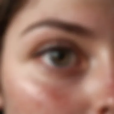 Understanding Eczema: A Closer Look Eczema skin condition with visible symptoms