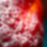 Understanding Lichen Sclerosus Manifestations Detailed examination of lichen sclerosus manifestations