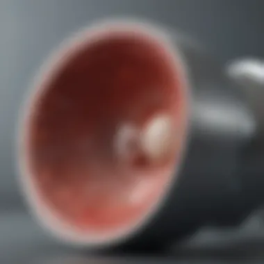Materials in Hip Implants Diagram of common materials used in hip implants