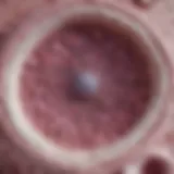Microscopic view of DCIS cells highlighting their structure
