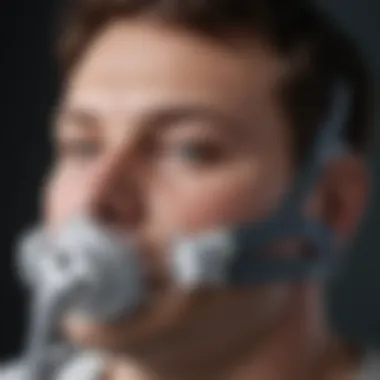 Provent CPAP device showcasing its design and features