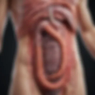 Gastrointestinal Tract and Ulcerative Colitis Visualization of the gastrointestinal tract highlighting areas affected by ulcerative colitis.